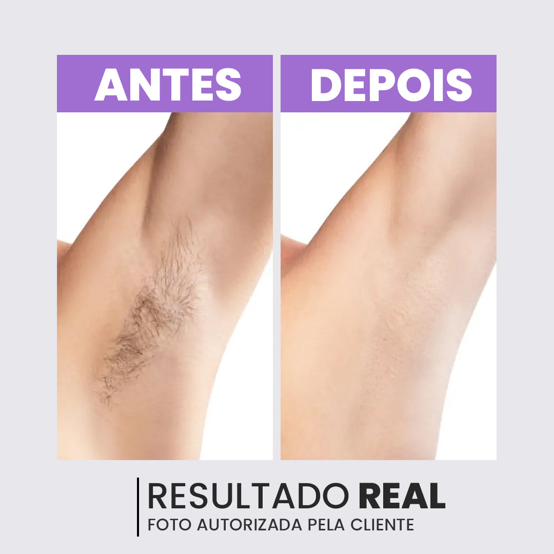 Bela Laser - Depilador Indolor 2 em 1 + [Brinde Exclusivo]