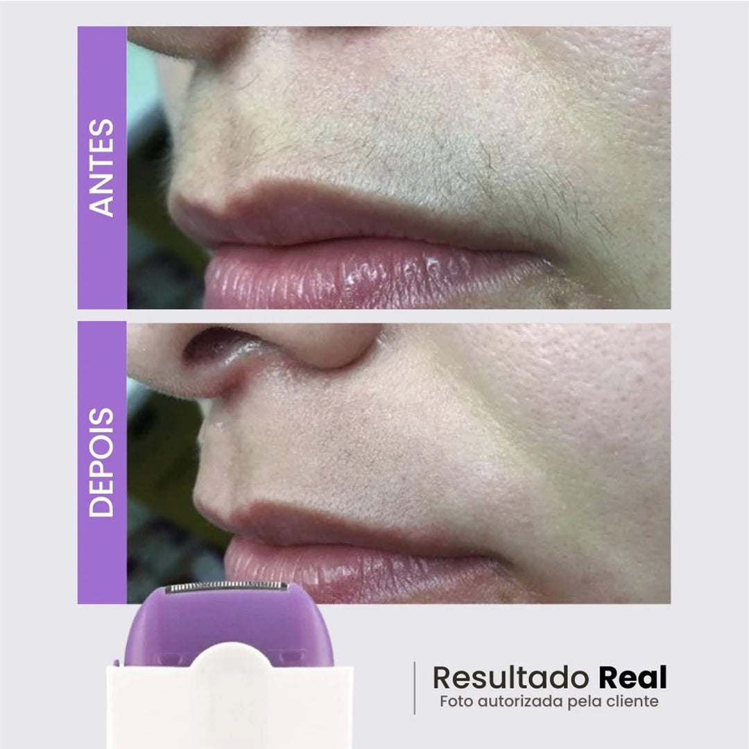 Bela Laser - Depilador Indolor 2 em 1 + [Brinde Exclusivo]